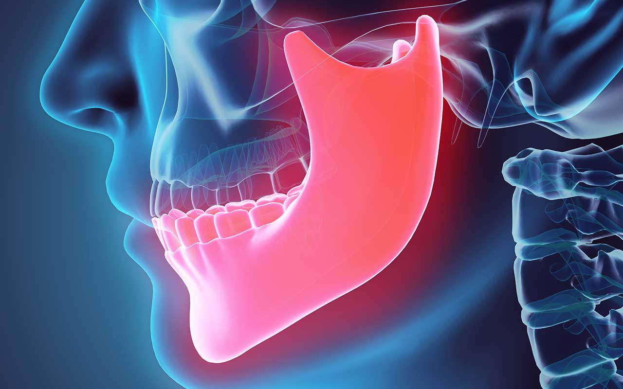Do you grind your teeth?