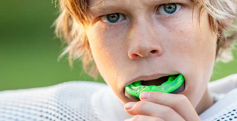 Is custom mouthguards necessary?