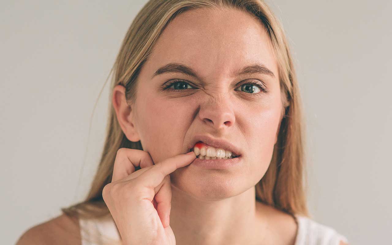 What is gum disease?