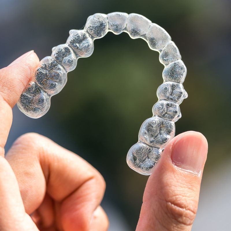 Clear Aligners at Hillier Road Dental