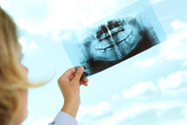 OPG and X-Rays at Hillier Road Dental