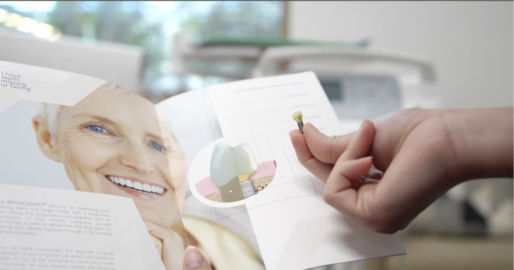 Implants at Hillier Road Dental